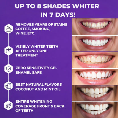 LumiViolet™ - Instant Teeth Brightening Strips - 1 pack (7strips)