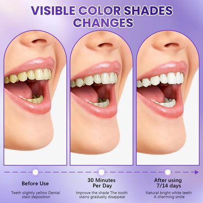 LumiViolet™ - Instant Teeth Brightening Strips - 1 pack (7strips)